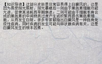 【营卫不和】白癜风医院专业 上海白癜风医院院址_兰州新闻网_名医名院